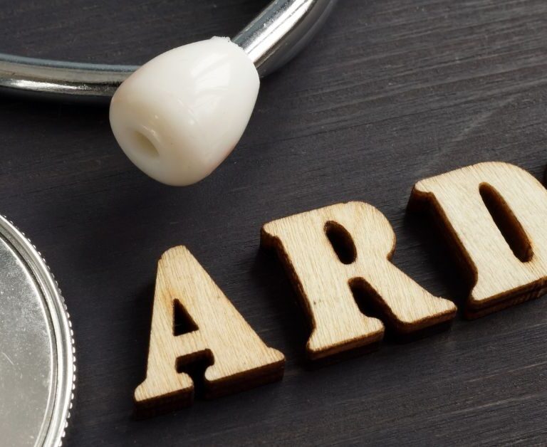 ARDS: Cause of death in COVID19