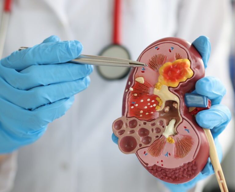 Renal Equations Concepts In order to understand the concepts of renal equations; we shall study the following: